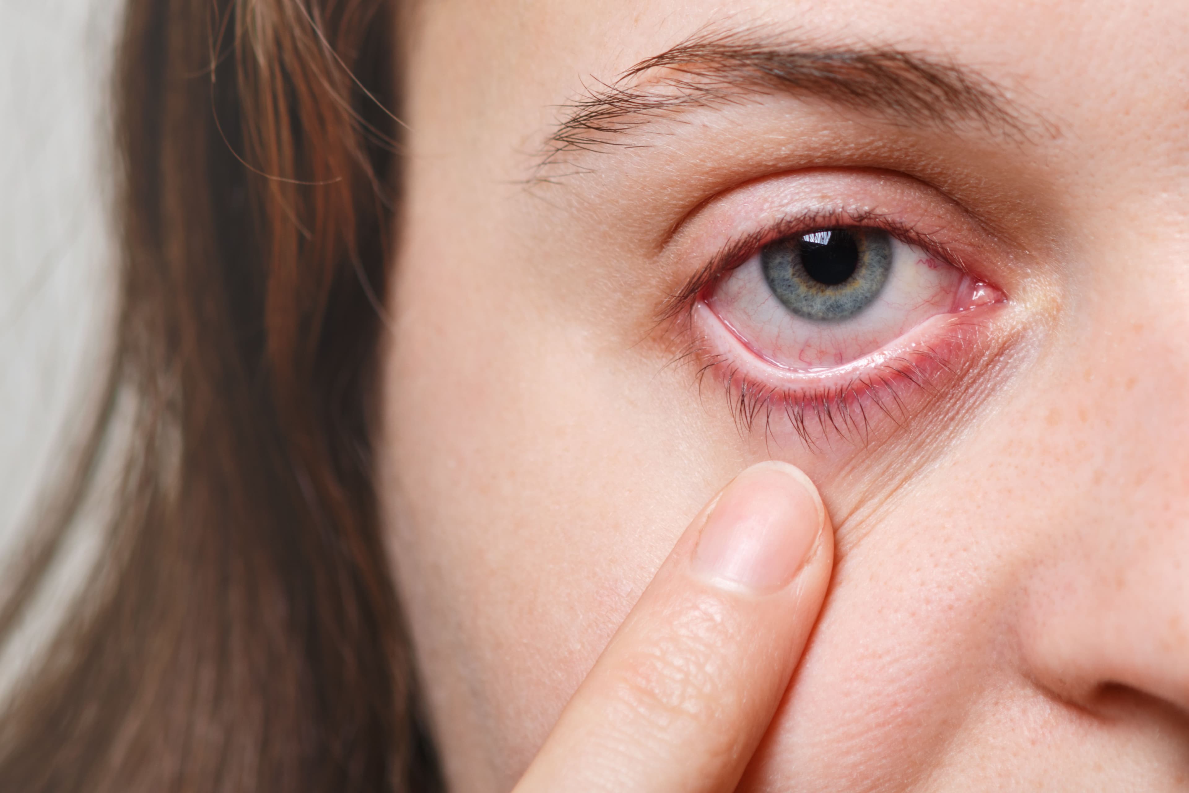 Image of eye.jpg