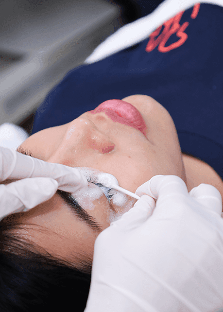 Image of eyelid spa.png